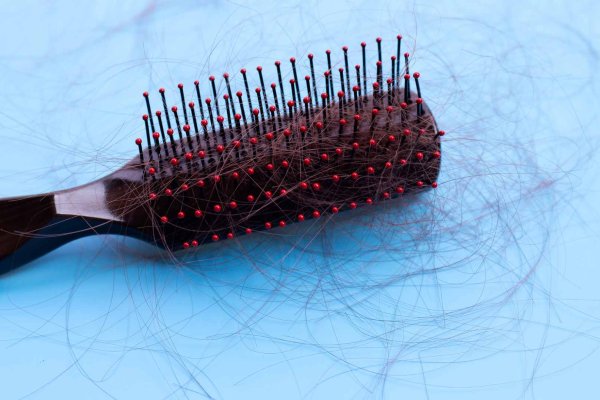 causes of hair loss in men and women