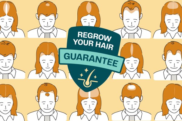 Treatable hair loss conditions