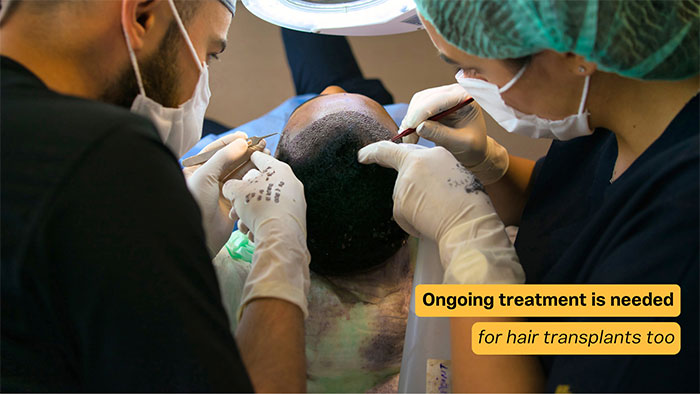 Everything You’ve Ever Wanted To Know About Hair Transplant Surgery! Image